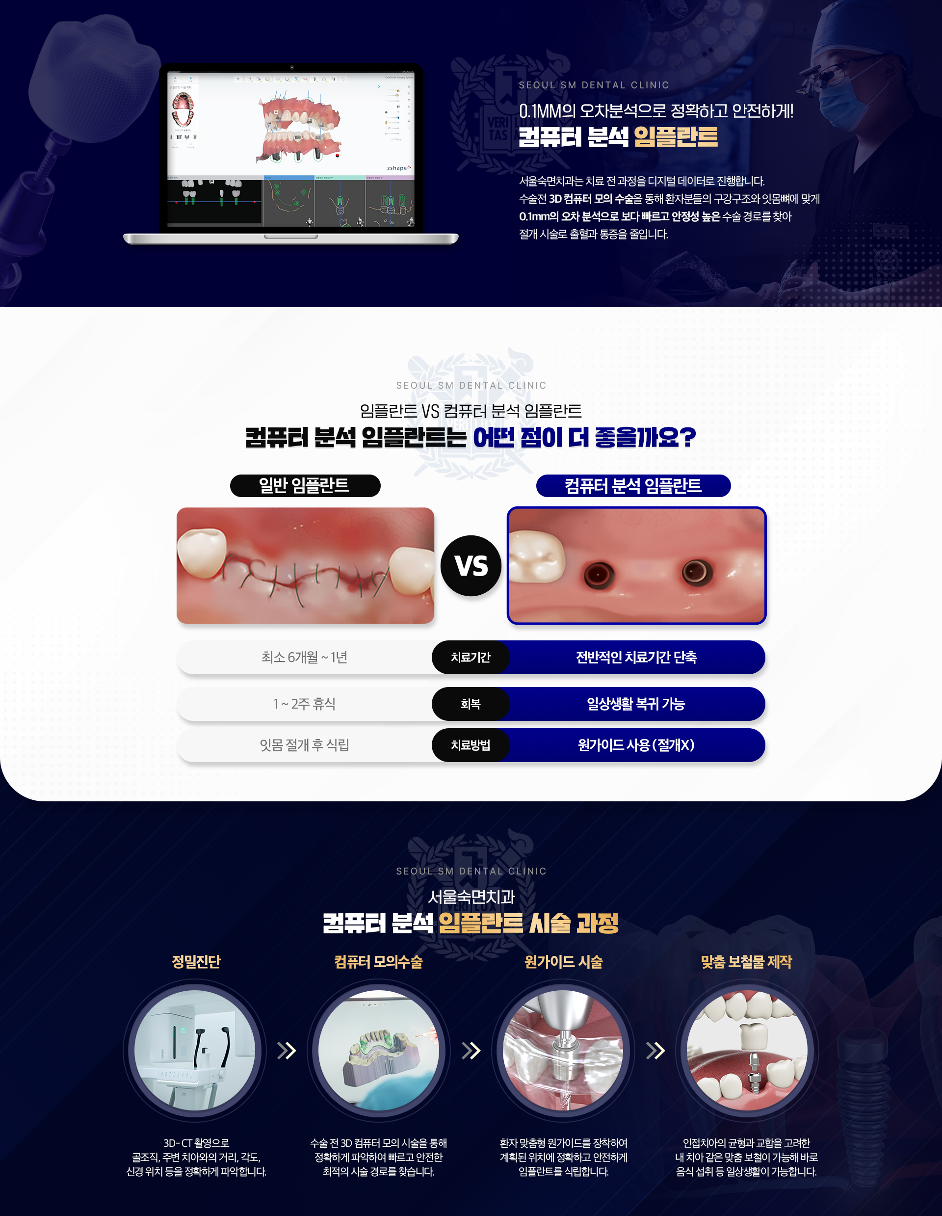 0.1mm의 오차분석으로 정확하고 안전하게! 컴퓨터 분석 임플란트-컴퓨터 분석 임플란트는 어떤 점이 더 좋을까요?-컴퓨터 분석 임플란트 시술 과정